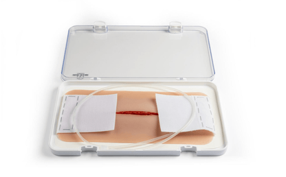 Wundmoulage Halsschnitt - Erler - Zimmer
