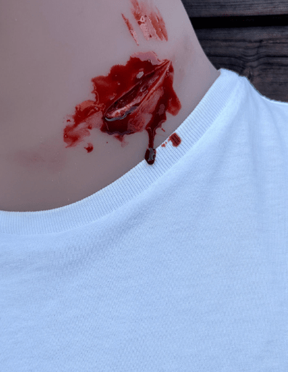 Wundmoulage Stichverletzung Hals - Erler - Zimmer