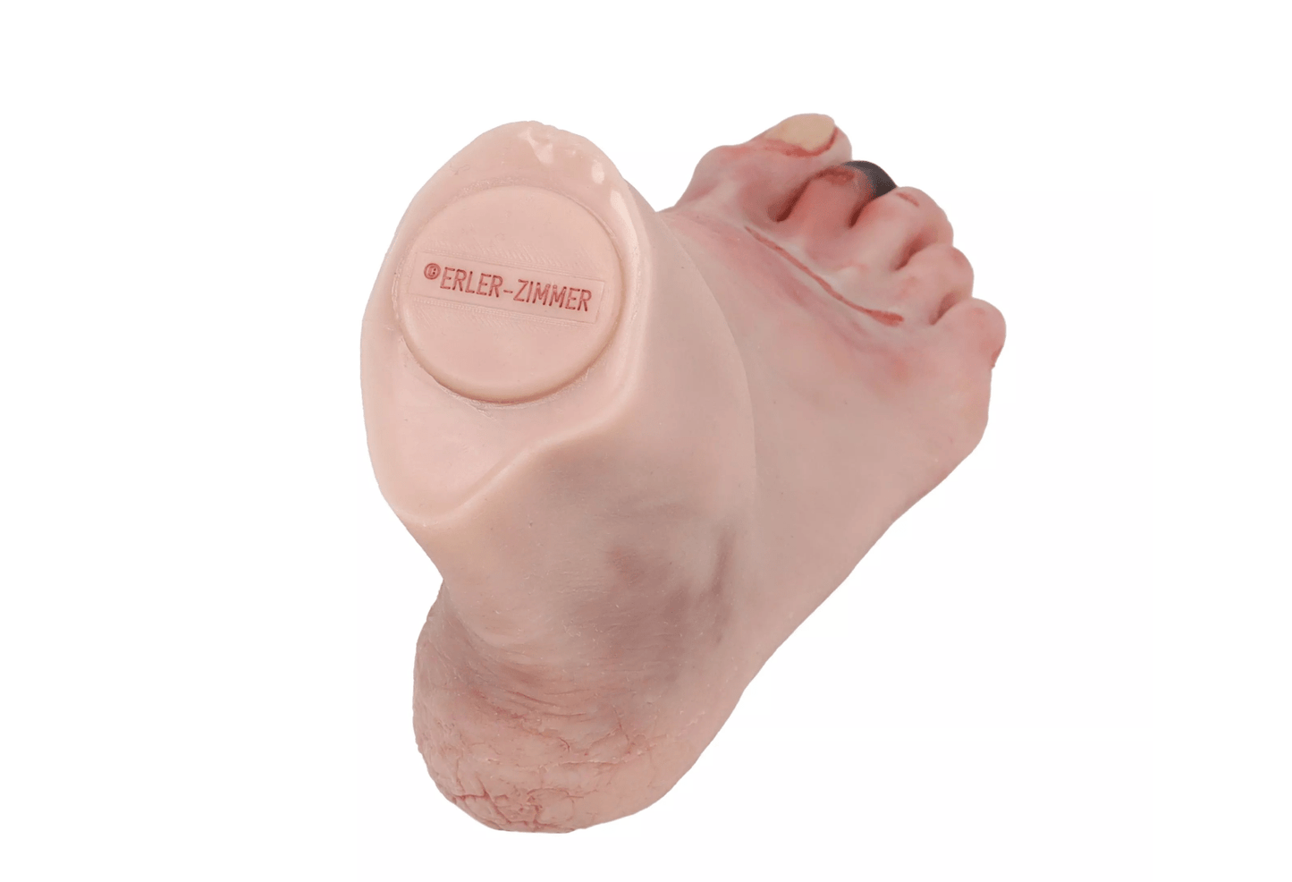 Wundenfuß mit diabetischem Fußsyndrom, fortg. Stadium, Puppenversion - Erler - Zimmer