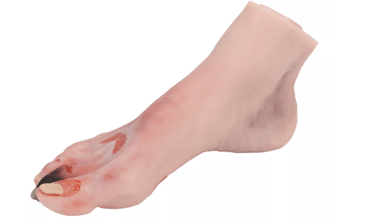 Wundenfuß mit diabetischem Fußsyndrom, fortg. Stadium, Puppenversion - Erler - Zimmer