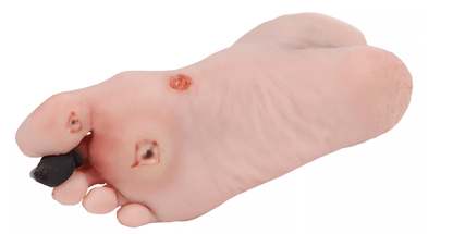 Wundenfuß mit diabetischem Fußsyndrom, fortg. Stadium, Puppenversion - Erler - Zimmer