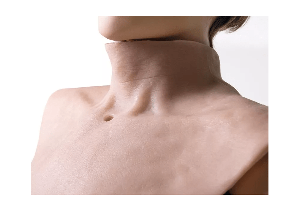 Simulationskragen "Tracheostomie" - Erler - Zimmer