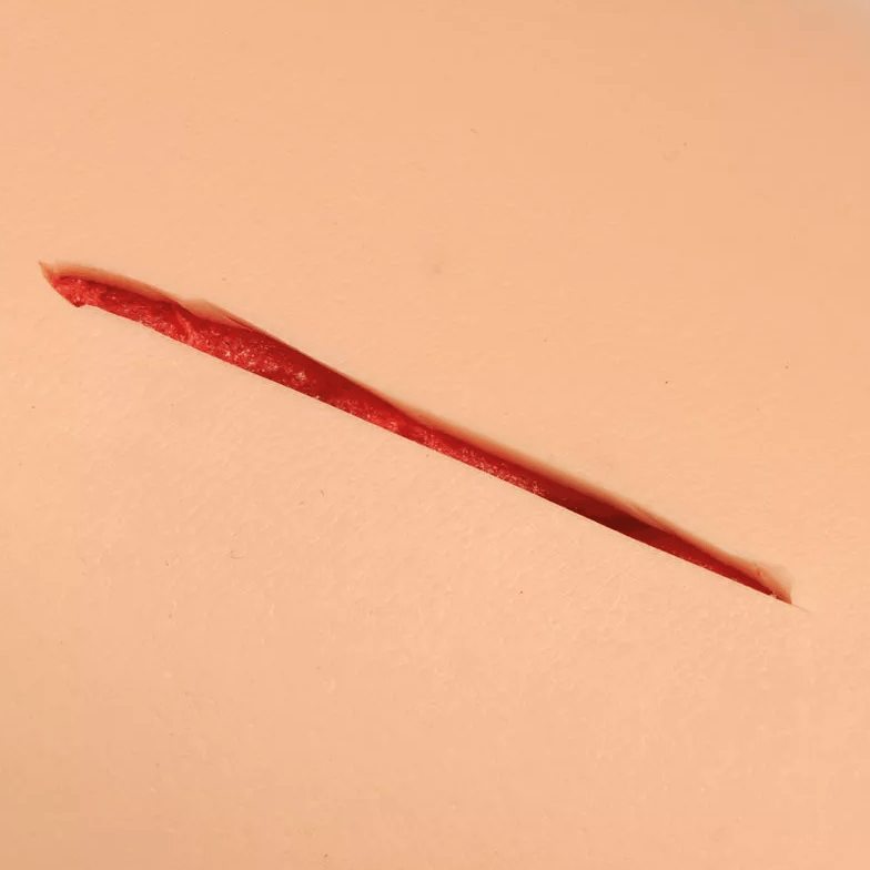 Naht - Arm - Erler - Zimmer