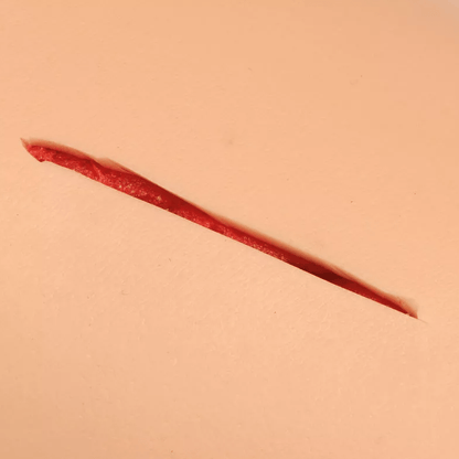 Naht - Arm - Erler - Zimmer