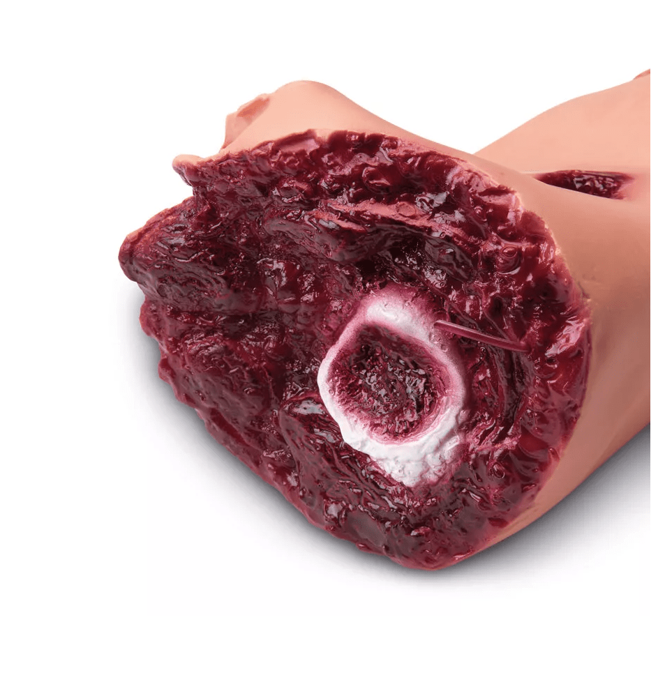 Wundensimulations - Set Multi - Erler - Zimmer