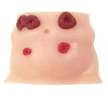 Stomapflege - Simulator - Erler - Zimmer