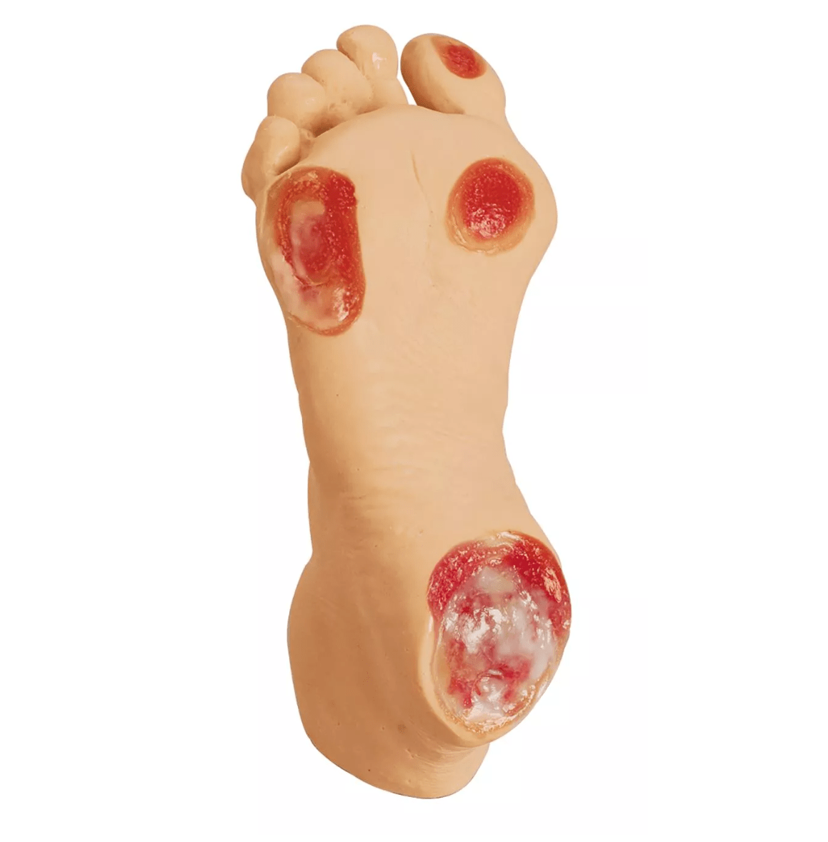 Senioren - Druckgeschwür - Fuß - Erler - Zimmer