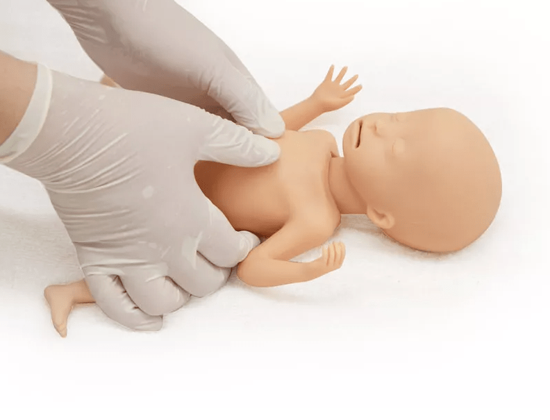 Frühgeborenes mit extrem niedrigem Geburtsgewicht (ELBW) - Erler - Zimmer