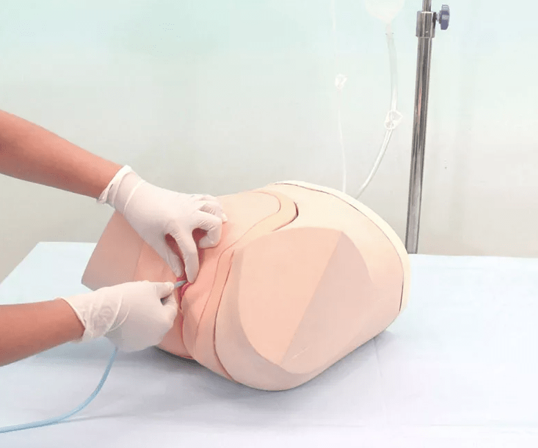 Katheterisierungs - /Einlauf - Simulator, weiblich - Erler - Zimmer