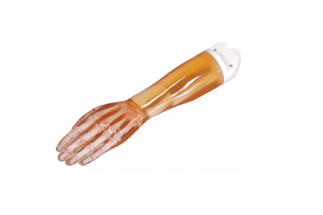 Frakturenhand mit Unterarm für R16900 - Erler - Zimmer