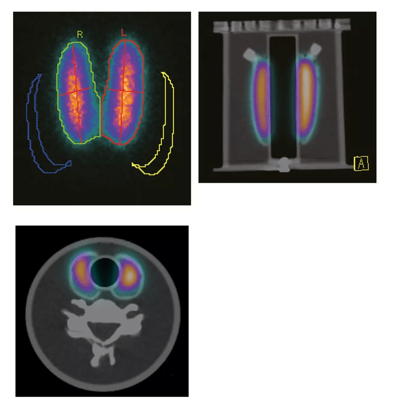 Schilddrüsenphantom UN - Erler - Zimmer