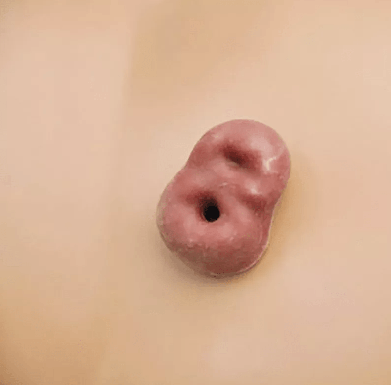 Krankenpflegepuppe, Standardausführung - Erler - Zimmer