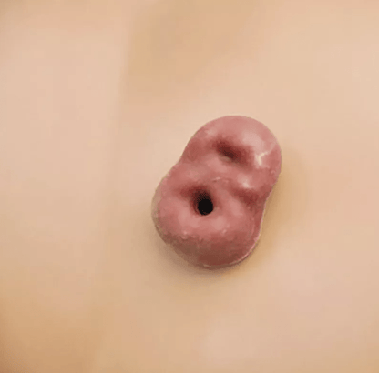 Krankenpflegepuppe, Standardausführung - Erler - Zimmer