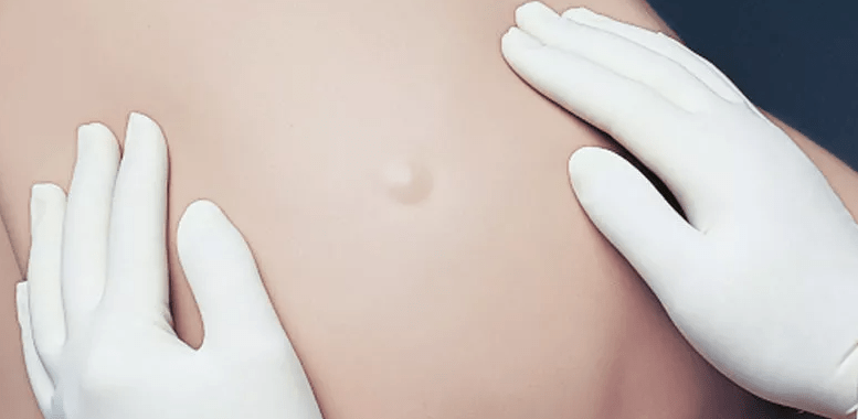 Noelle Geburtstorso - Erler - Zimmer