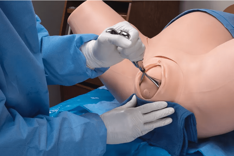 Super OB Susie - Erler - Zimmer