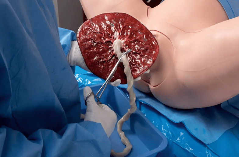 Super OB Susie - Erler - Zimmer