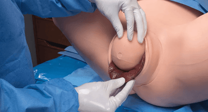 Super OB Susie - Erler - Zimmer