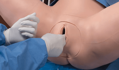 Super OB Susie - Erler - Zimmer