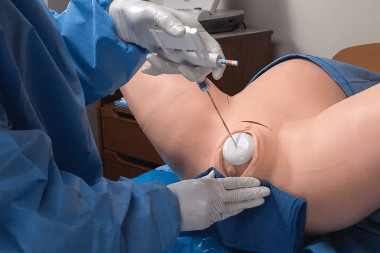 Super OB Susie - Erler - Zimmer