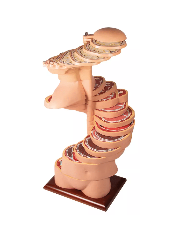 Scheibentorso, natürliche Größe - Erler - Zimmer