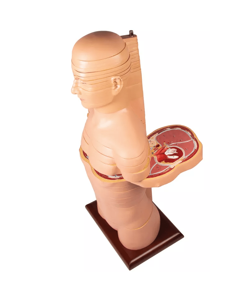 Scheibentorso, natürliche Größe - Erler - Zimmer