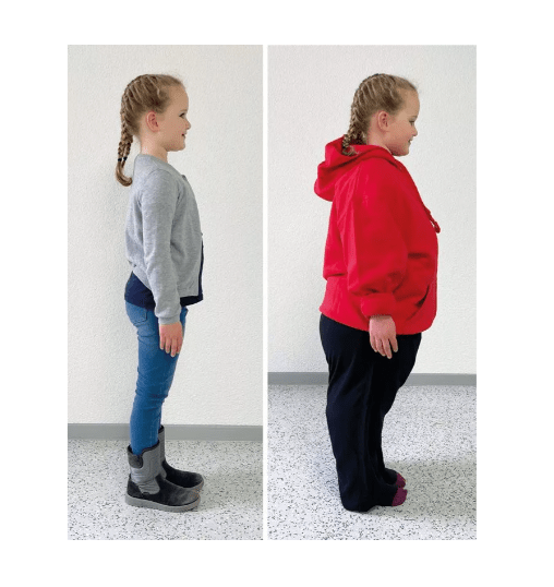 PAT Junior – Kinder Adipositas Trainer - Erler - Zimmer