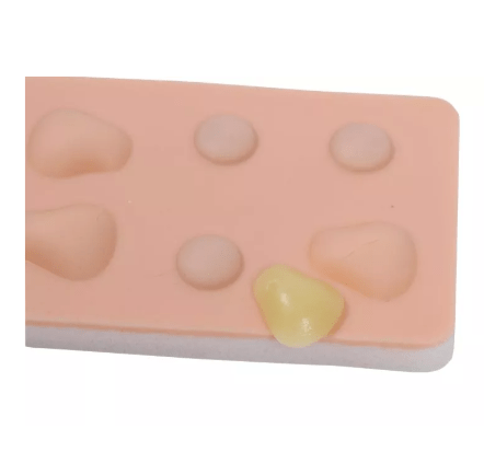 Übungspad Zyste und Abszess - Erler - Zimmer