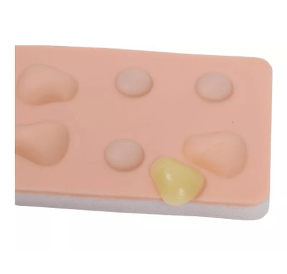 Übungspad Zyste und Abszess - Erler - Zimmer