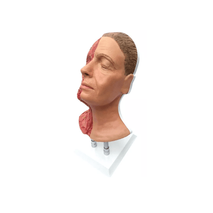 Kopf für Gesichtsinjektionen mit Muskeln, Arterien und Nerven - Erler - Zimmer