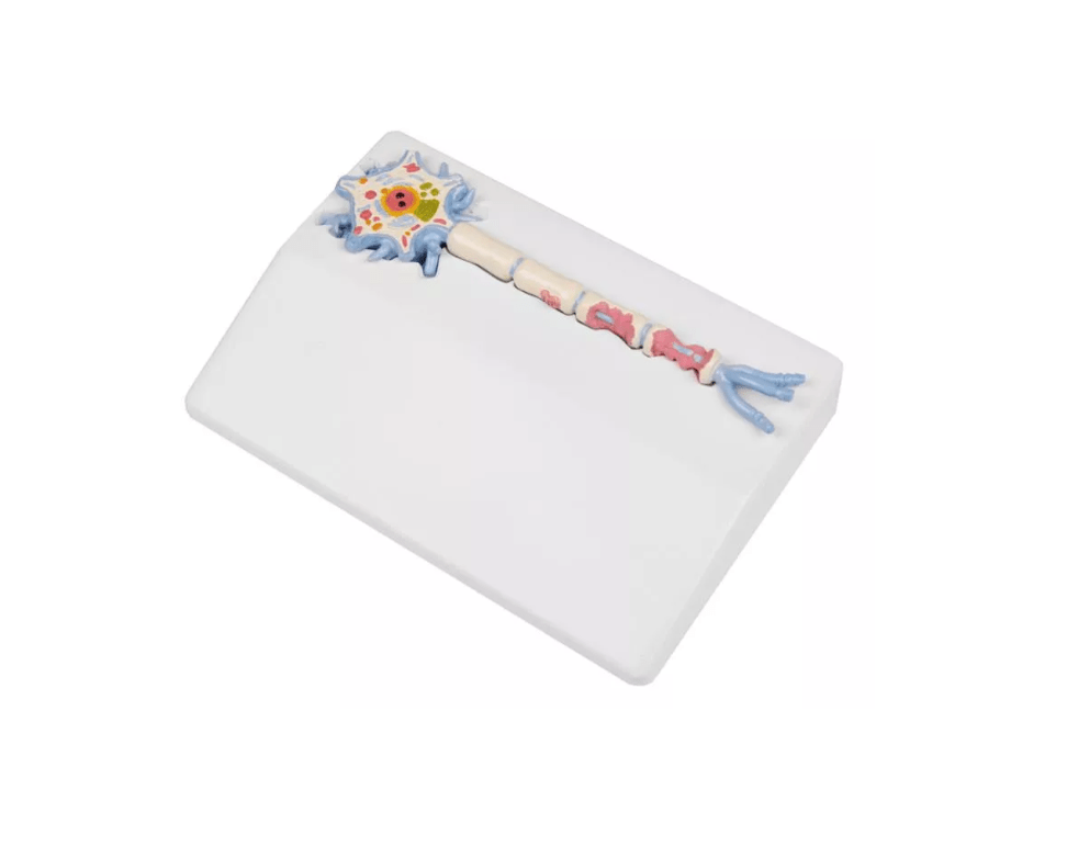 Neuronmodell mit Stadien der Multiplen Sklerose - Erler - Zimmer