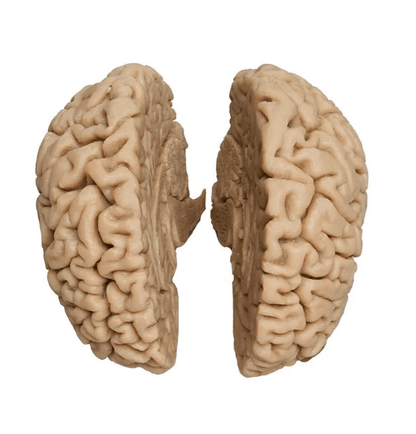 Menschliches Gehirn, Naturabguss - Erler - Zimmer