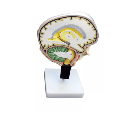 Hirnschnitt - Erler - Zimmer