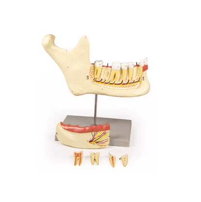 Unterkiefer, 6 Teile - Erler - Zimmer