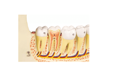 Unterkiefer, 6 Teile - Erler - Zimmer