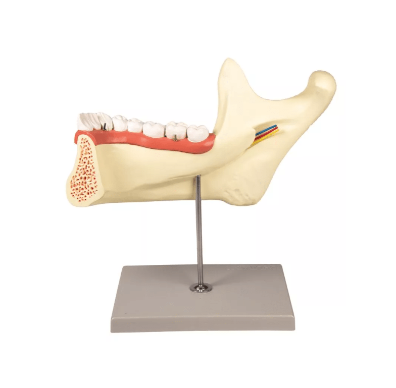 Unterkiefer, 6 Teile - Erler - Zimmer