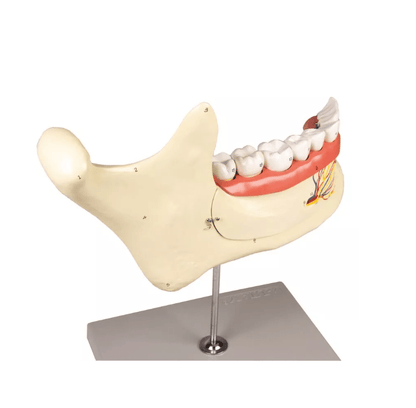 Unterkiefer, 6 Teile - Erler - Zimmer