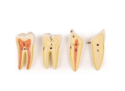 Unterkiefer, 6 Teile - Erler - Zimmer