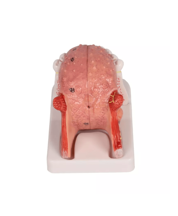 Zungen - und Zahnmodell, lebensgroß, 4 - teilig - Erler - Zimmer