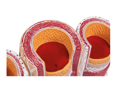 Arterie und Venen Modell, 20 - fach vergrößert - Erler - Zimmer
