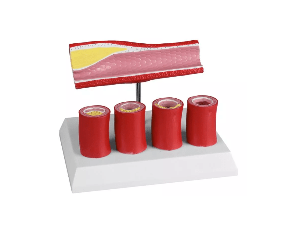 Arterie mit 4 Arterienschnitten - Erler - Zimmer