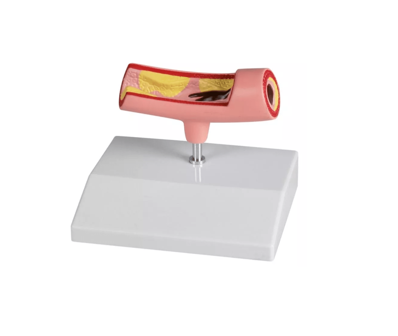 Arterienmodell - Erler - Zimmer