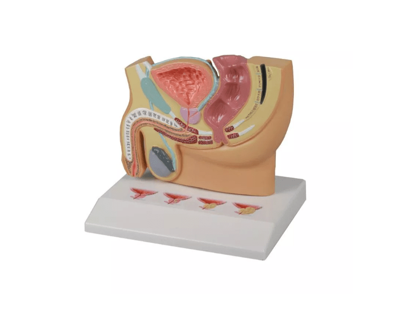 Männlicher Beckenschnitt mit Prostataerkrankungen - Erler - Zimmer