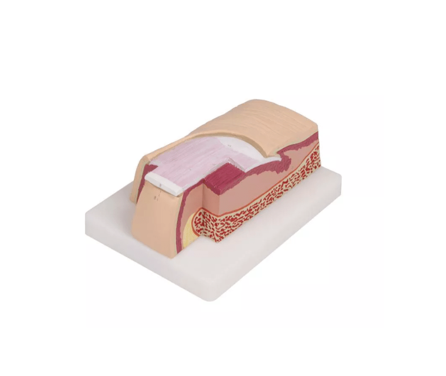 Nagel - Modell, 5 - fache Größe - Erler - Zimmer