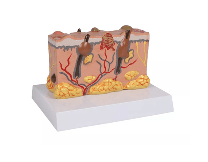 Pathologisches Hautmodel - Erler - Zimmer
