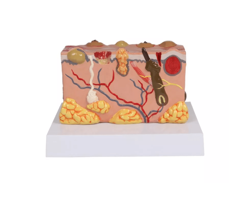 Pathologisches Hautmodel - Erler - Zimmer