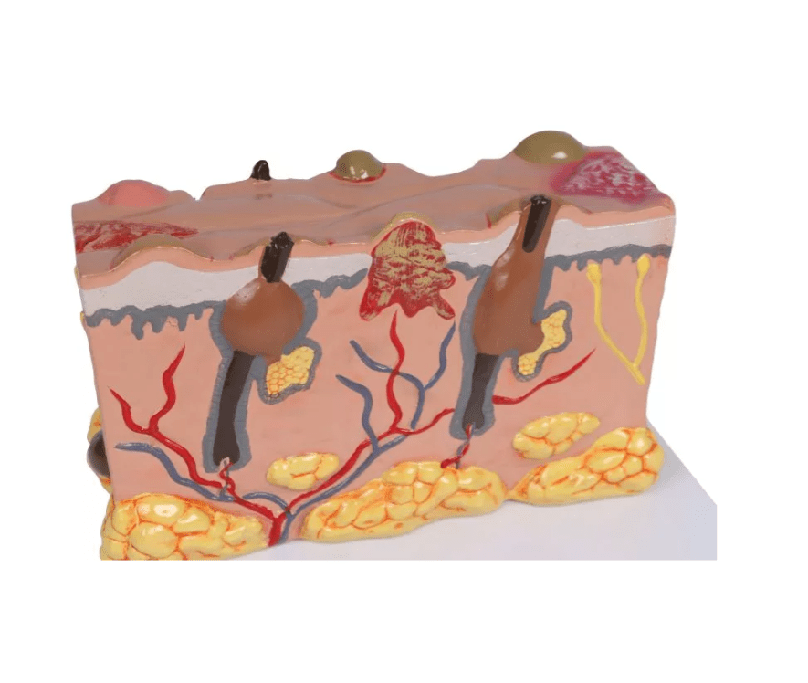 Pathologisches Hautmodel - Erler - Zimmer