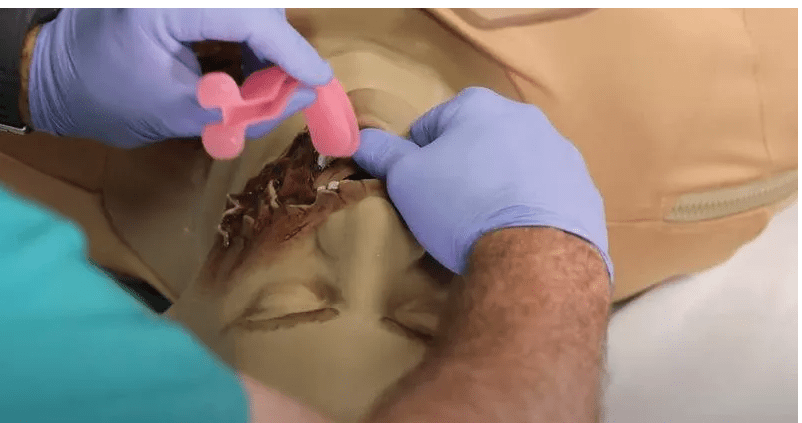 Casualty Care Rescue Randy - Erler - Zimmer