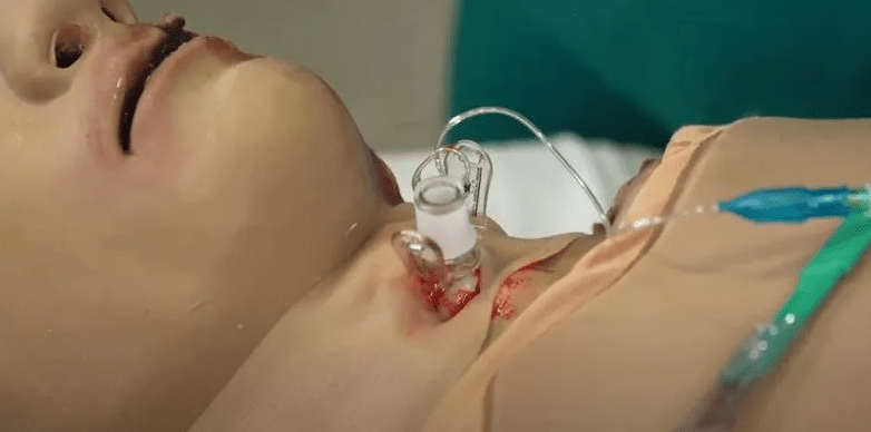 Casualty Care Rescue Randy - Erler - Zimmer