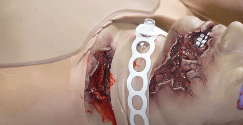 Casualty Care Rescue Randy - Erler - Zimmer