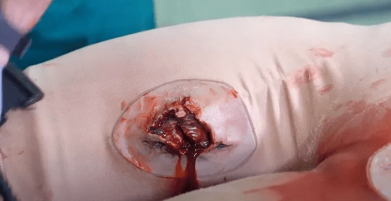 Casualty Care Rescue Randy - Erler - Zimmer